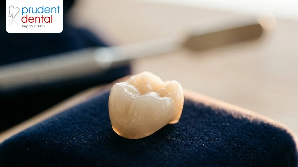 How long do dental crowns last? (And how to extend it)