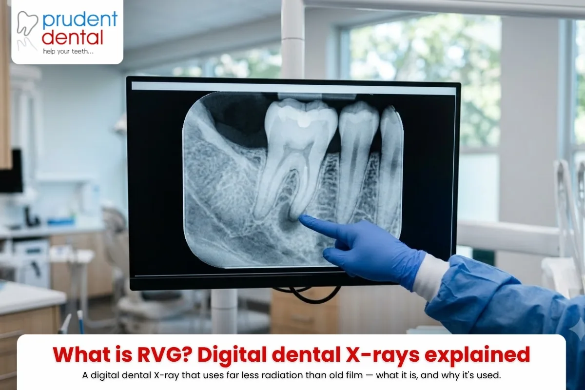 What is RVG? Digital dental X-rays explained