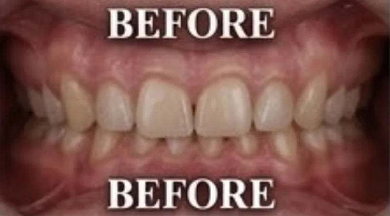 Case 5, Uniform, brighter smile, patient's teeth before treatment at Prudent Dental Clinic (published with consent)